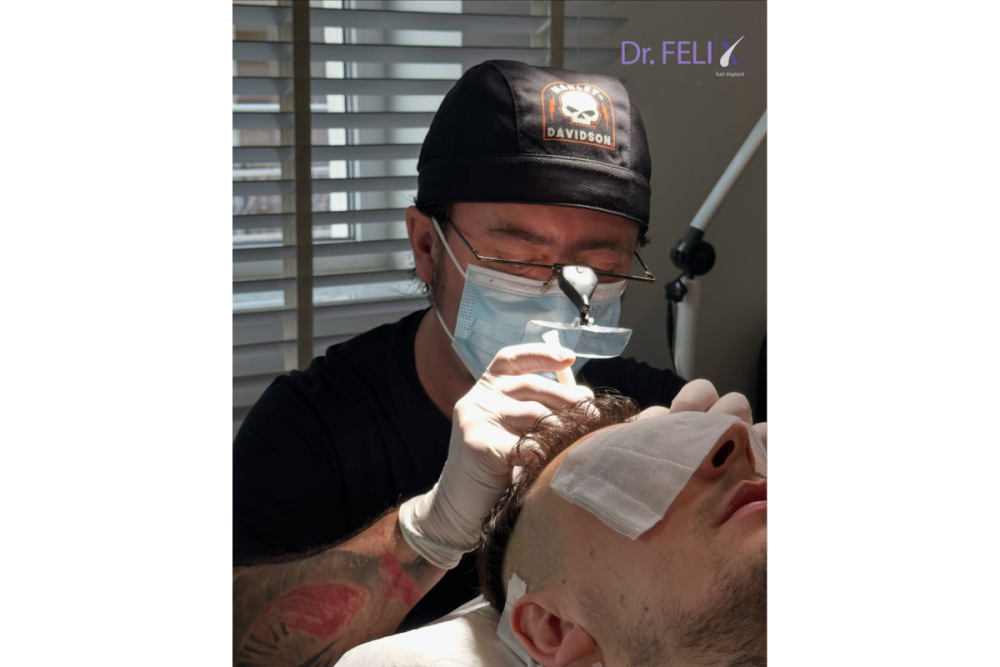 Este mai avantajos un transplant de păr la Dr. Felix Hair Implant din București, România?