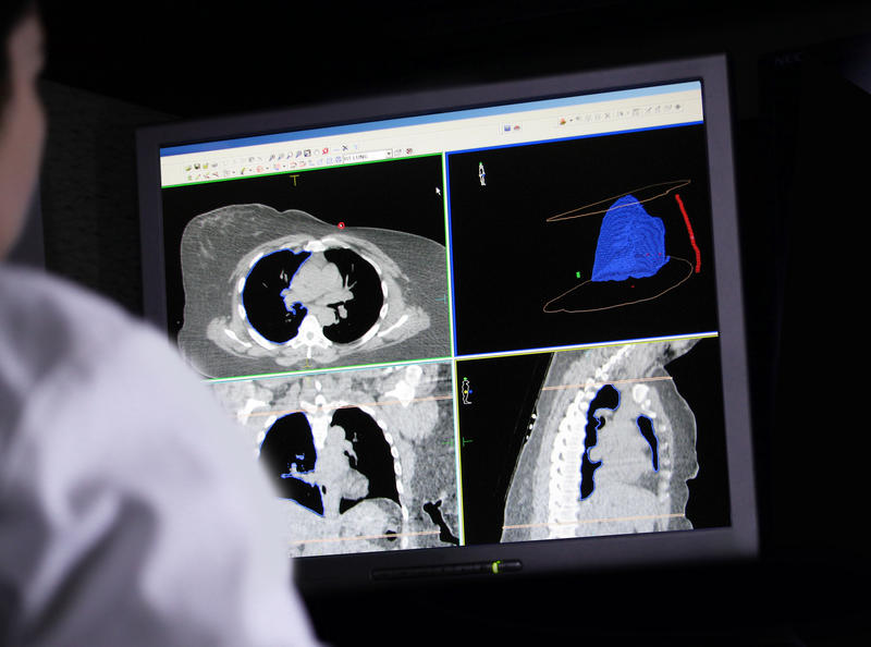Creșterea numărului de cazuri de cancer în UE are un impact social și economic tot mai semnificativ.