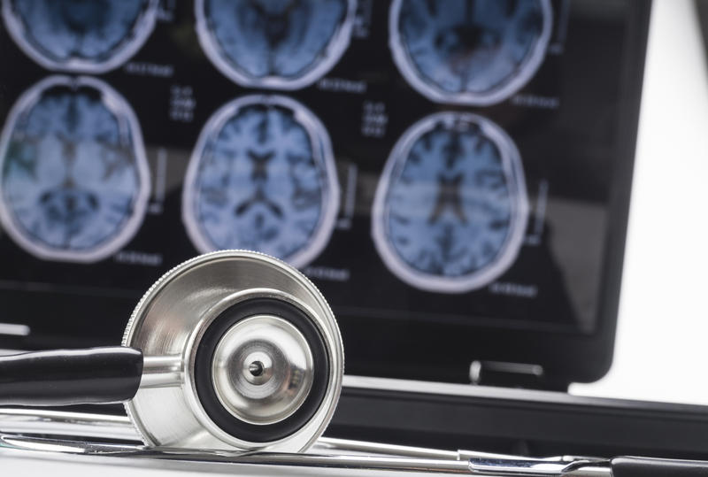 Poluarea aerului, legată direct de dezvoltarea bolii Alzheimer. Cercetare pe 27 de milioane de indivizi